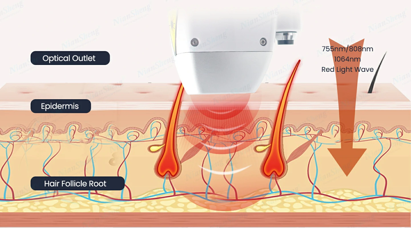 Niansheng Beauty diode laser hair moval machine -y20