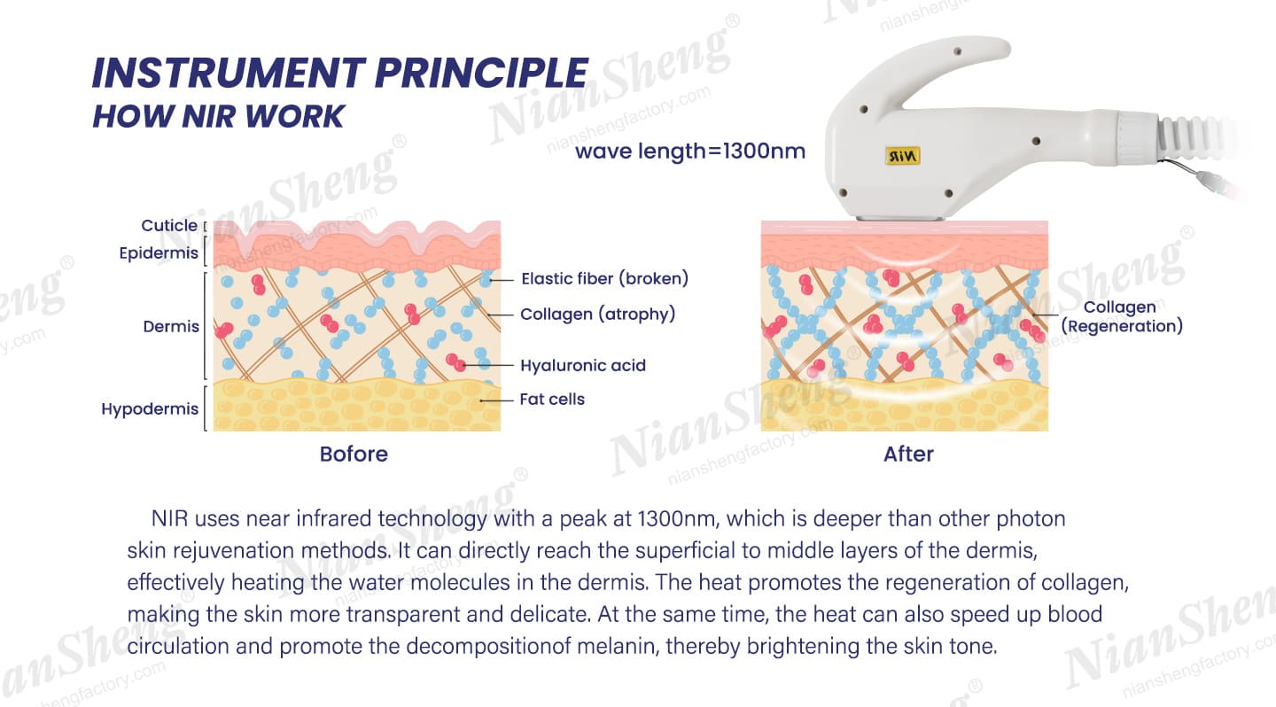 2 in 1 DPL Hair Removal+NIR Skin Rejuvenation Two New Technology Machine