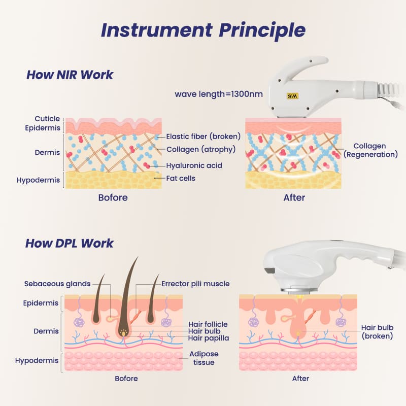 2 in 1 DPL Hair Removal+NIR Skin Rejuvenation Two New Technology Machine